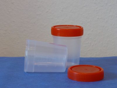 Steril vizeletgyűjtő pohár csavaros tetővel ml